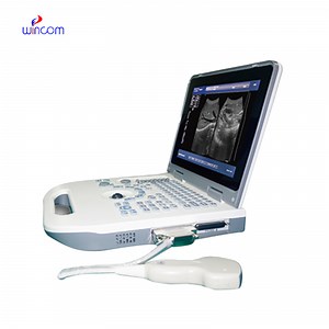 [Hot Item] Portable Full Digital Laptop Ultrasonic Diagnostic System Ultrasound Scanner Machine with Probes for Clinic Hospital