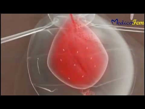 trypanosoma cruzi development and life cycle in vector || Chagas disease