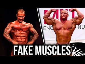 The WORST Implants In Bodybuilding!