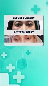 Blepharoplasty Patient Journey | Day by Day Recovery | Upper & Lower Eyelid Surgery |