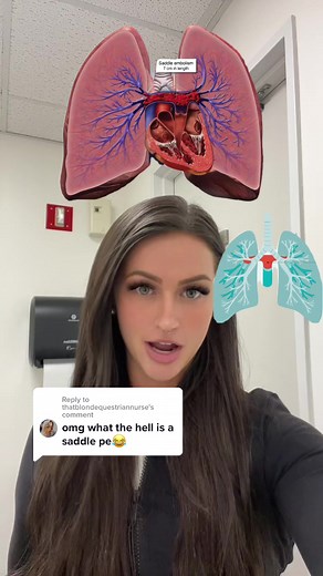 Understanding Saddle Pulmonary Embolism - What You Need To Know