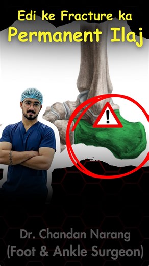 Dr Chandan Narang on Instagram: "Edi ka fracture (Calcaneal fracture) pair ke heel bone ka fracture hota hai, jo chalne–phirne mein kaafi problem create karta hai. Aise cases mein sahi time par specialist treatment bahut zaroori hota hai. 👣 Dr. Chandan Narang, Foot & Ankle Surgeon, Calcaneal (Heel Bone) Fracture Treatment provide karte hain — patient ki condition ke according non-surgical ya surgical treatment options ke saath. 📍 Consultation Location: Fortis Hospital, Mohali – Sector 62 📞 Fo