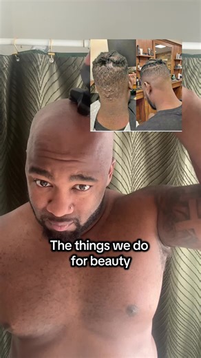 Effective Tips to Eliminate Shaving Bumps