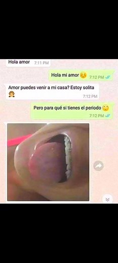 😂😂 | Albert GAMER