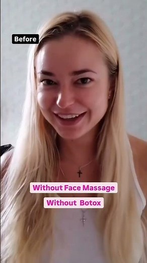 What Botox Really Does to You