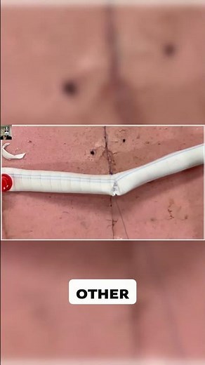 5.2 Avoiding Common Suturing Mistakes in Practice ⚠️ #drstrangemch #hospital #cardiovascularsurgery