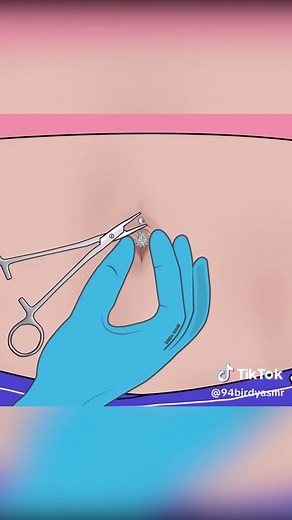 Satisfying ASMR Navel Piercing Removal Animation