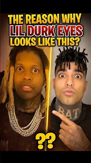 Why Lil Durk Eyes Is Like This?