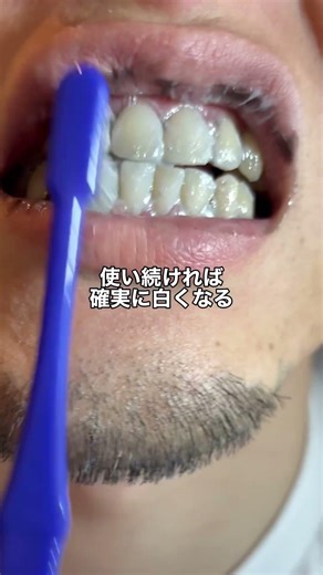 This is what whitened my teeth! I get asked a lot about where I got it for 680 yen, so I put the ...