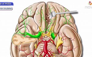 Circle of Willis