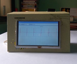 Portable ECG Machine