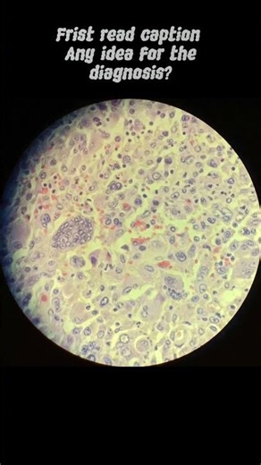 Radical cystectomy specimen from a 77 years old male. #anatomy #pathology #pathologies