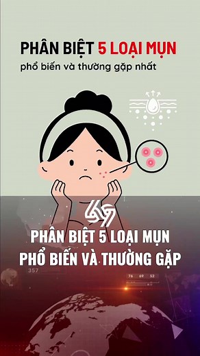 Trả lời @user6314006924357 Phân biệt 5 loại mụn phổ biến và thường gặp nhất #69channel1 #news #xuhuong #tiktoknews #sinhvien #congai #LearnOnTikTok #HelloVietnam