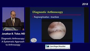 Diagnostic Arthroscopy: A Systematic Approach to Arthroscopy