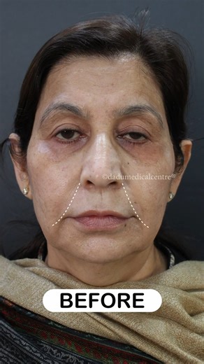 10K views · 27 reactions | Witness the incredible before and after...