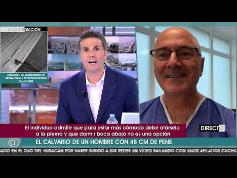 El pene más grande del mundo, 48 centímetros: un caso de macrofalosomía