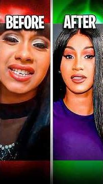 Rap's Most Surprising Surgery Reveals 😱