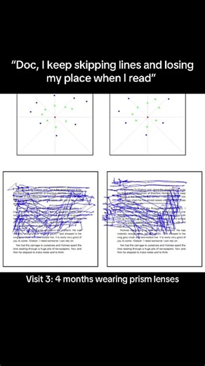 Reading is a workout when your eyes are misaligned