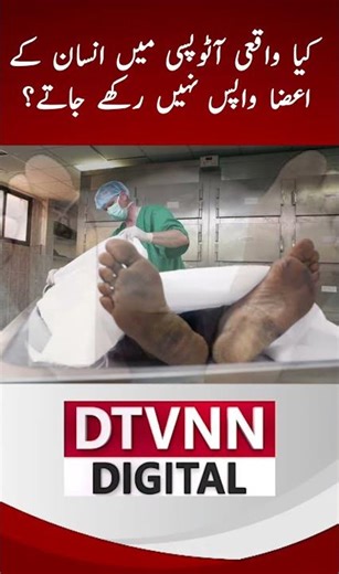 What Happens to Organs After Autopsy? #shorts