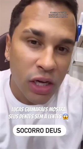 Lucas Guimarães mostra seus dentes sem a lentes #lucasguimaraes #carlinhos #carlinhosmaia