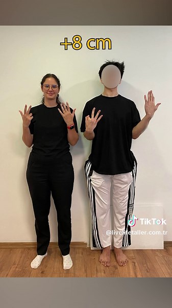 Increase Height: 1.73m to 1.82m - Limb Lengthening Transformation