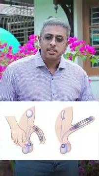 Diabetes Erectile Dysfunction Causes, Symptoms & Treatment