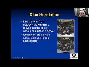 Sciatica Management: Understanding Your Spine and Treatment Options