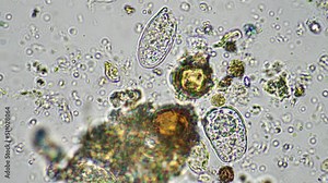 soil microorganisms nematode, microarthropods, micro arthropod, tardigrade, and rotifers a soil sample, soil fungus and bacteria on a regenerative farm in compost. Science under the microscope