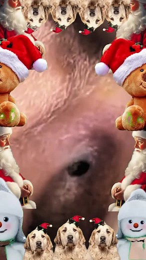 Ultimate Pimple Popping Compilation