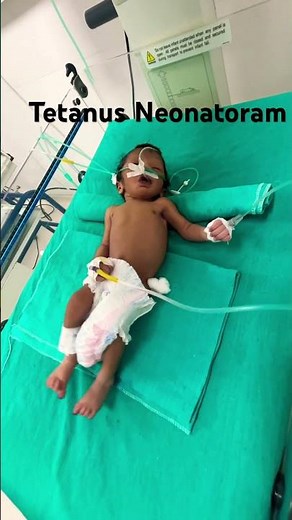 Tetanus in newborn is a fatal disease .#Tetanus #neonatology