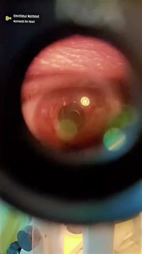 slit lamp microscope view