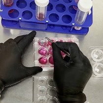 Video: Direct and Indirect Culture Methods for Studying Biodegradable Implant Materials In Vitro