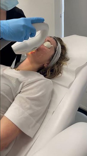 IPL laser treatment demo at Quinn Clinics Bristol