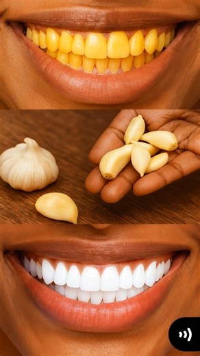 Secret that Dentists don't want you to know: Remove Tartar and Teeth Whitening in just 2 minutes🪥🦷 | Rooted Health