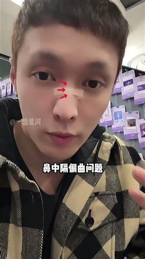 Zhang Yixing's Shocking Hiatus: The Truth Behind the Year-Long Rumor