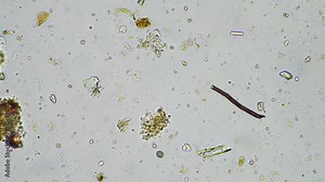soil microorganisms in a soil life sample from a sustainable agriculture farm. living food web or bacteria fungi and protozoa