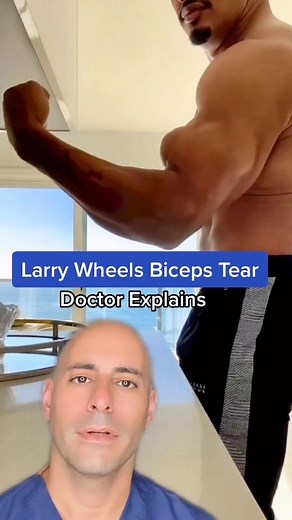 Does Larry Wheels have a proximal biceps tear?💪 This is when the biceps tears off from the shoulder. You don’t get much loss of function with this proximal biceps tear variant. Alternatively, if you have a distal biceps tear by the elbow, you get loss of strength and forearm rotation (supination). It appears as this bulge when the torn proximal biceps tendon retracts down in the upper arm. 😷✅Follow @dr.davidabbasi for More Daily Medical Content & Health Tips! #larrywheels #powerlifting #bodybu