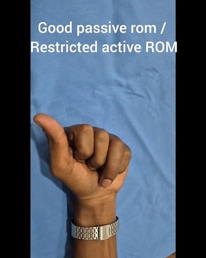 Flexor Tenolysis/ Hand surgery by Dr Raghuram Menon- Plastic surgery #handsurgery