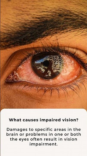 What is a visual disturbance? | What causes impaired vision? | Apollo Hospitals