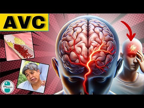Stroke Warning Signs: Cerebrovascular Accident