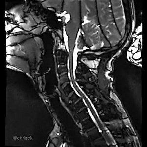 26K views · 532 reactions | #DYNAMIC_MRI #NOVEMBER #THEME #AIRWAY...