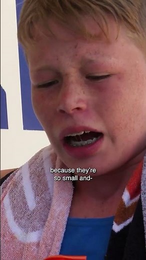 His foot is full of sea urchin spines.. 😦 #bondirescue #bondibeach #shorts