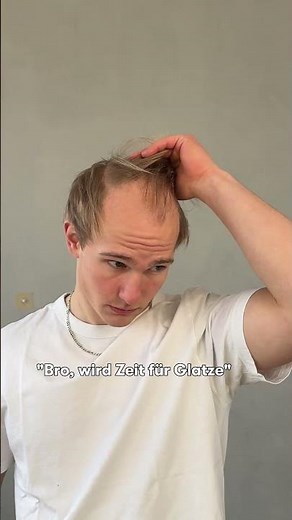 Zeit für Glatze oder Haarsystem?! 👩‍🦲 #hairsystem #haarausfall #vorhernachher #beforeandafter