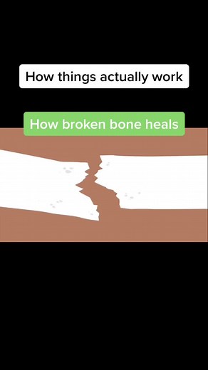 ⚠️follow for more⚠️ #fyp #foryou #howthingsactuallywork