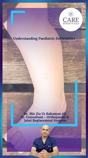 Understanding Paediatric Deformities | Dr. Mir Zia Ur Rahaman Ali | CARE Hospitals, Banjara Hills