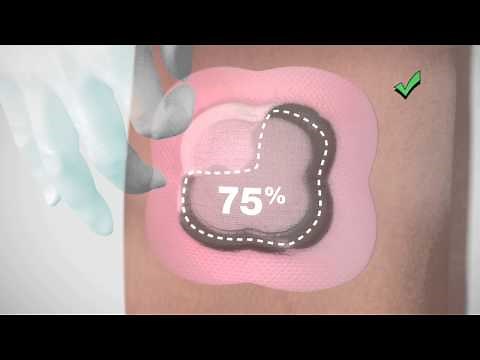 When to Change ALLEVYN Life Foam Dressing