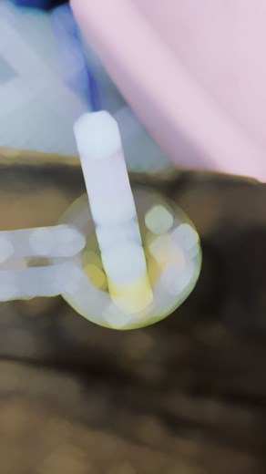 Understanding HCG Test Results Clearly