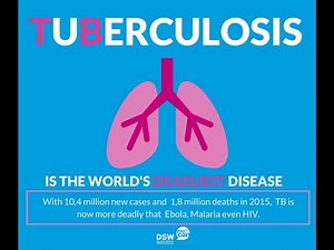 Classification of tuberculosis Using Deep Learning