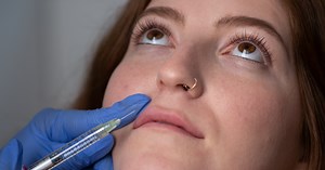 I Got Lip Injections For The First Time — & I Love The Results