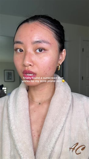 Best SPF for Acne-Prone Skin: Ultra Violette Review